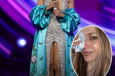 Jennifer Lopez suffers painful facial injury during AMAs 2025 rehearsals
